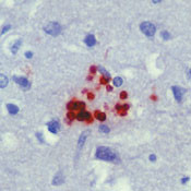 Toxoplasma Gondii Antibody in Immunohistochemistry (IHC)