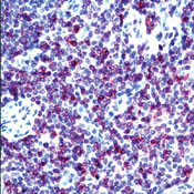 CD3e Antibody in Immunohistochemistry (Paraffin) (IHC (P))