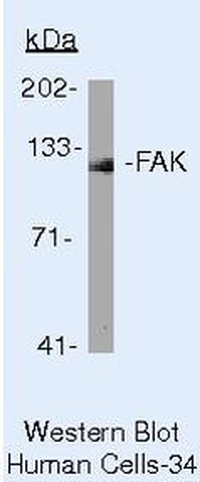 FAK Antibody in Western Blot (WB)