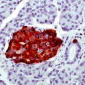 Chromogranin A Antibody in Immunohistochemistry (IHC)