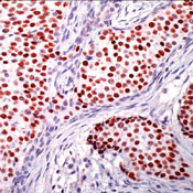 Progesterone Receptor Antibody in Immunohistochemistry (IHC)