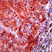 S100 Antibody in Immunohistochemistry (IHC)