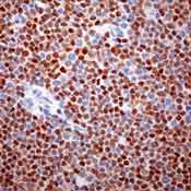 Cyclin D1 Antibody in Immunohistochemistry (Paraffin) (IHC (P))