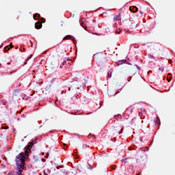 D4-GDI Antibody in Immunohistochemistry (IHC)