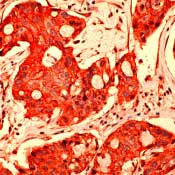 ErbB4 Antibody in Immunohistochemistry (IHC)