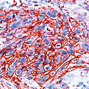 GLUT1 Antibody in Immunohistochemistry (Paraffin) (IHC (P))