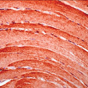 Myoglobin Antibody in Immunohistochemistry (IHC)