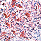 Osteopontin Antibody in Immunohistochemistry (Paraffin) (IHC (P))