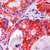 APC Antibody in Immunohistochemistry (IHC)
