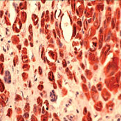 S100A4 Antibody in Immunohistochemistry (IHC)