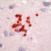 Toxoplasma Gondii Antibody in Immunohistochemistry (IHC)