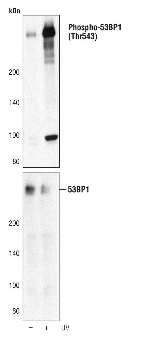 Phospho-53BP1 (Thr543) Antibody in Western Blot (WB)