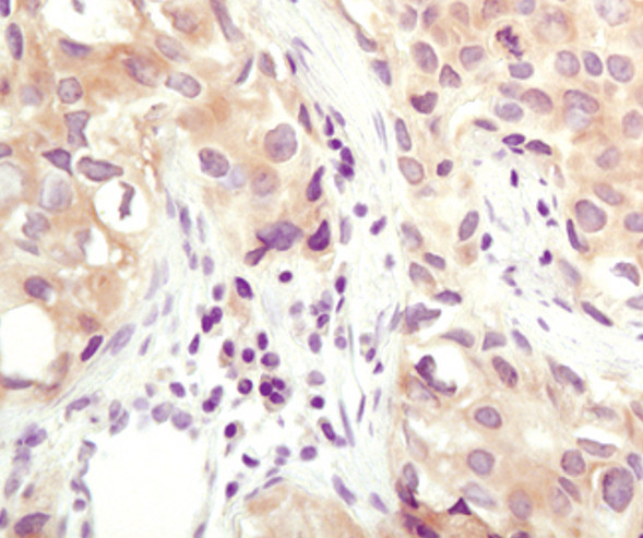 Calcyclin Antibody in Immunohistochemistry (Paraffin) (IHC (P))
