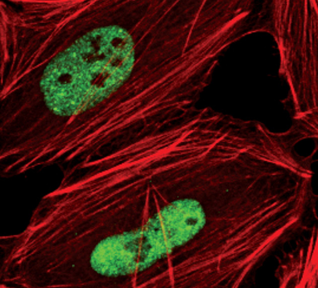 TDP-43 Antibody in Immunocytochemistry (ICC/IF)