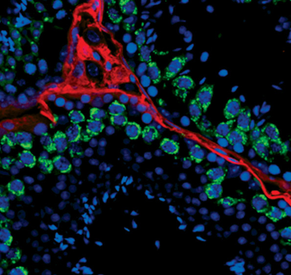 PIWIL1 Antibody in Immunohistochemistry (IHC)