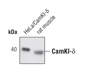 CAMK1D Antibody in Western Blot (WB)