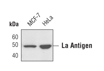 SSB Antibody in Western Blot (WB)