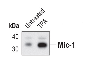 GDF15 Antibody in Western Blot (WB)