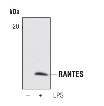 CCL5 (RANTES) Antibody in Western Blot (WB)