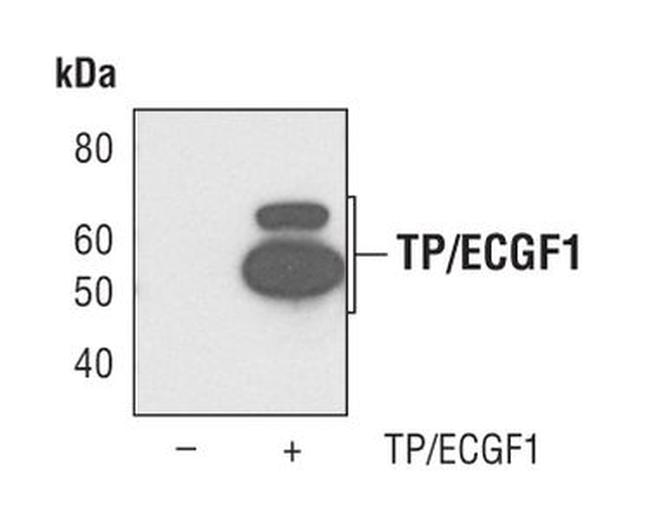Thymidine Phosphorylase Antibody in Western Blot (WB)