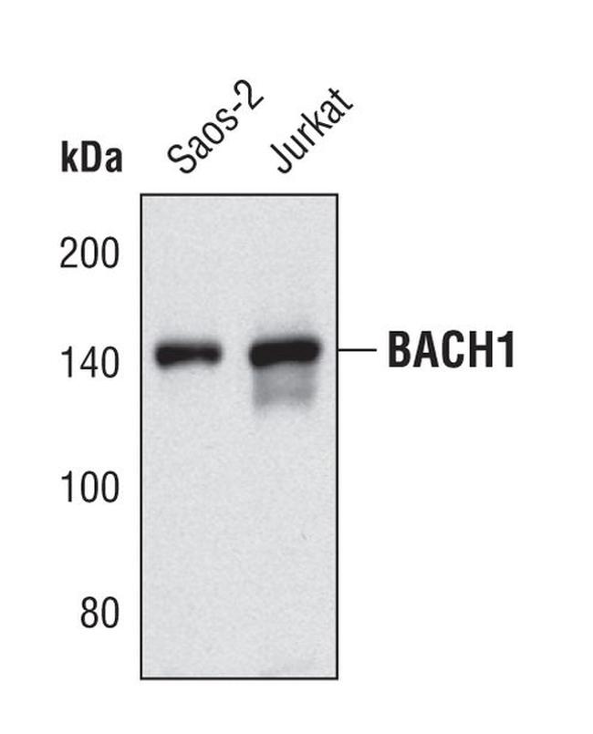 BRIP1 Antibody in Western Blot (WB)