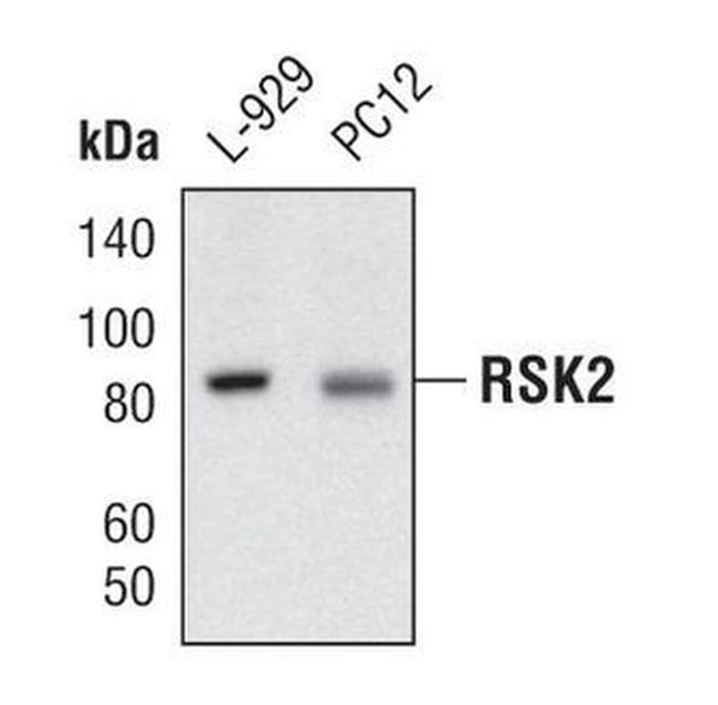 RSK2 Antibody in Western Blot (WB)