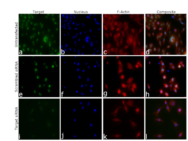 JMJD1B Antibody in Immunocytochemistry (ICC/IF)