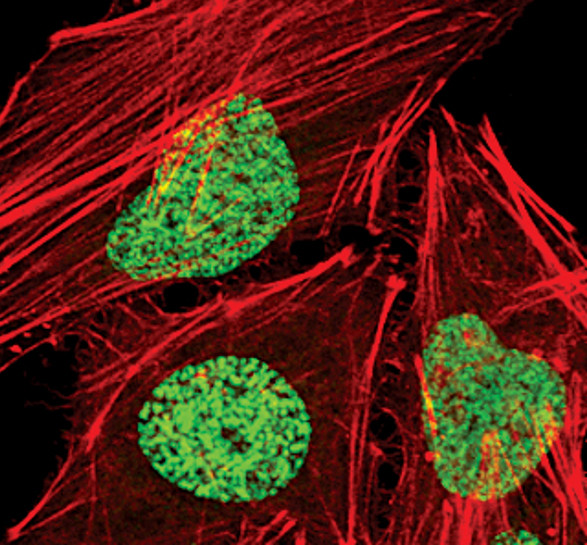 H3K27me3 Antibody in Immunocytochemistry (ICC/IF)