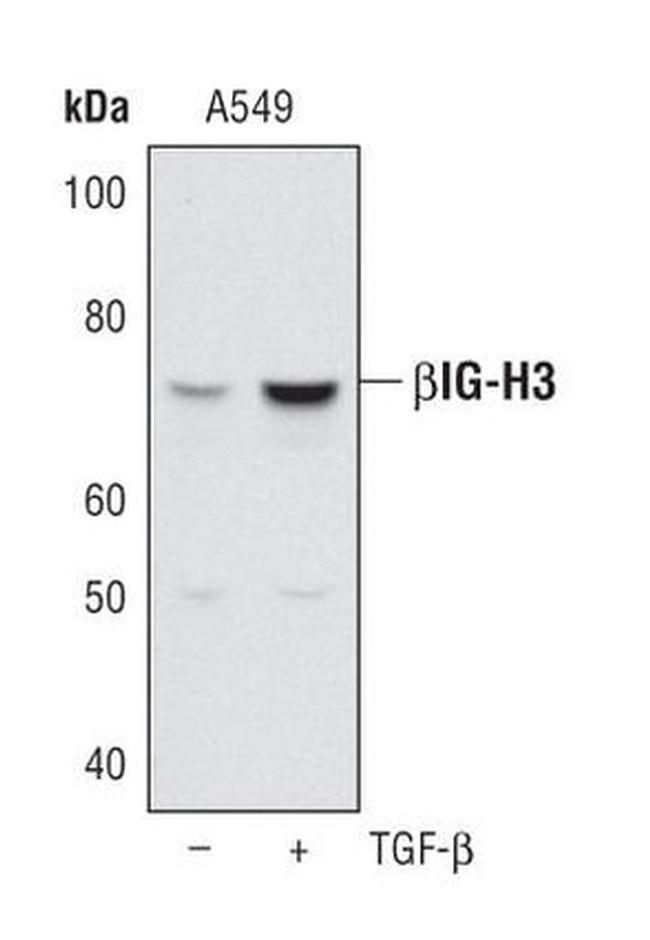 TGFBI Antibody in Western Blot (WB)