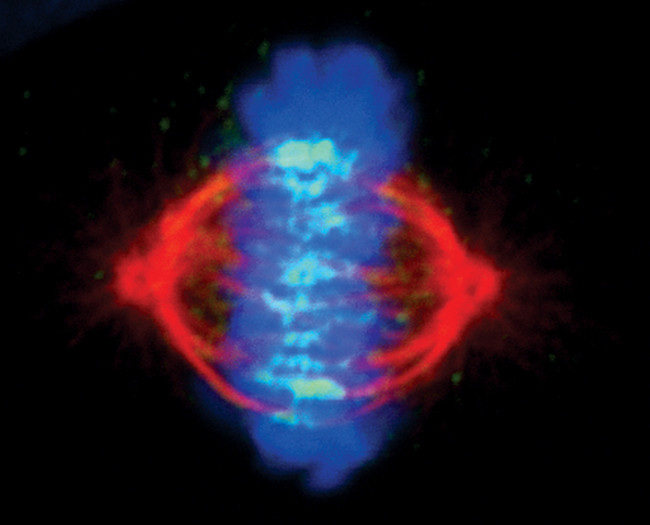 INCENP Antibody in Immunocytochemistry (ICC/IF)