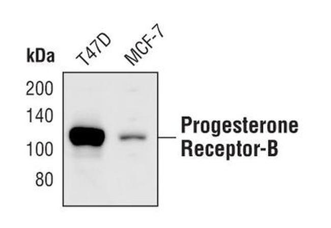 Progesterone Receptor Antibody in Western Blot (WB)