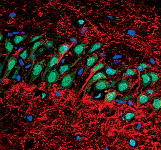 APE1 Antibody in Immunohistochemistry (IHC)
