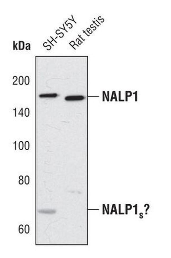 NALP1 Antibody in Western Blot (WB)