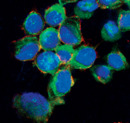 IRF5 Antibody in Immunocytochemistry (ICC/IF)