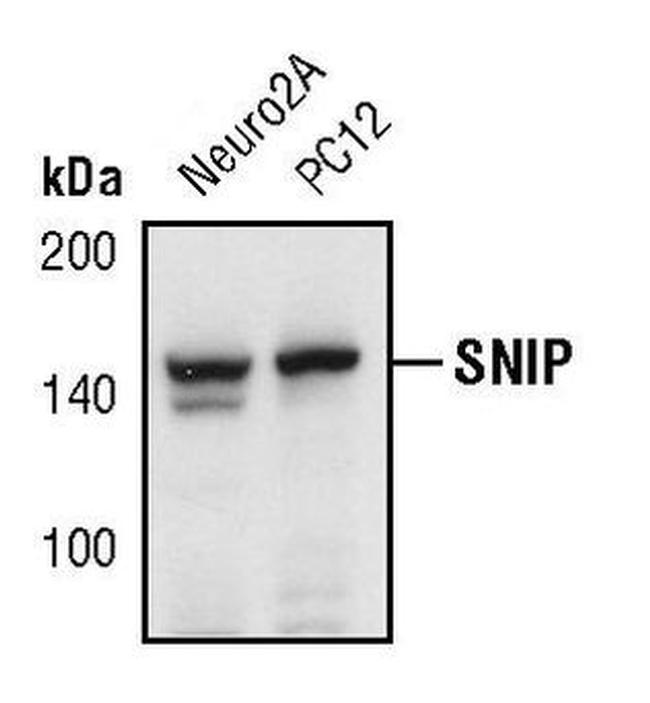 SNIP Antibody in Western Blot (WB)