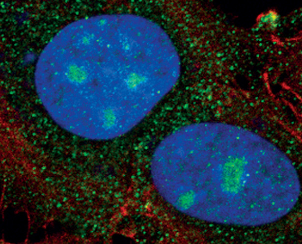 PSME2 Antibody in Immunocytochemistry (ICC/IF)