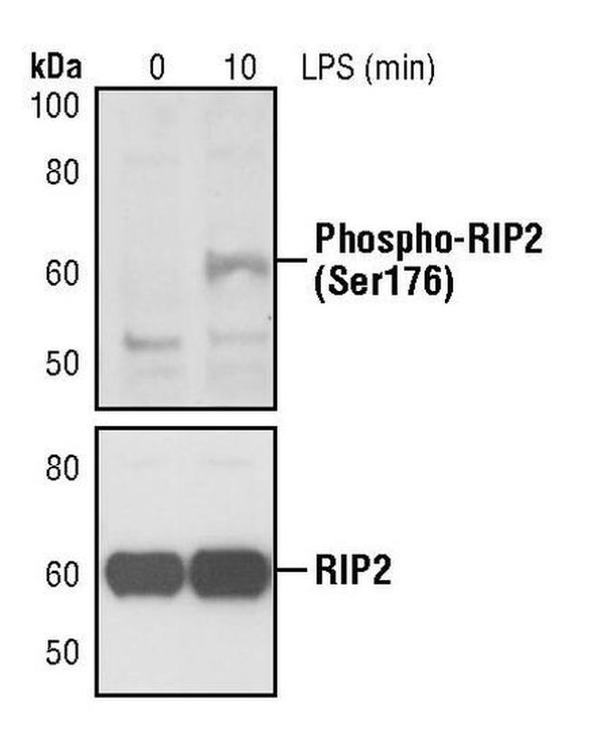 Phospho-RIP2 (Ser176) Antibody in Western Blot (WB)