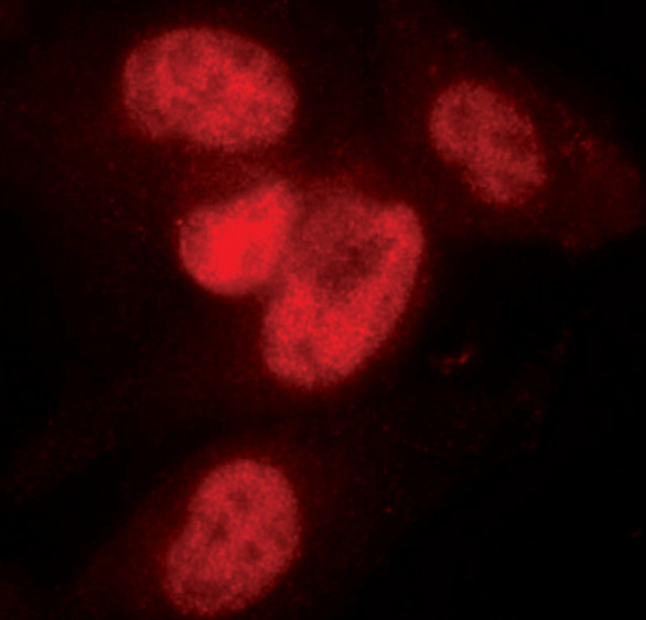 SnoN Antibody in Immunocytochemistry (ICC/IF)