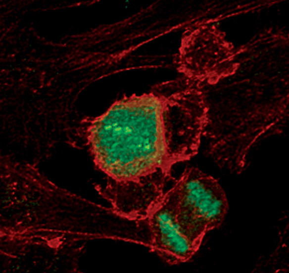 Phospho-Histone H3 (Thr11) Antibody in Immunocytochemistry (ICC/IF)