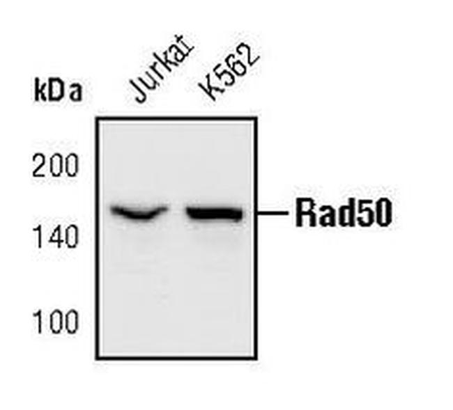 RAD50 Antibody in Western Blot (WB)