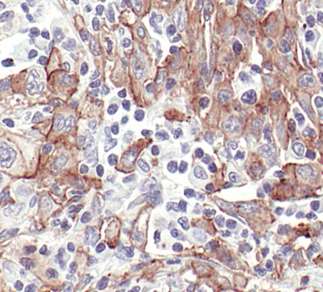 Caveolin 1 Antibody in Immunohistochemistry (Paraffin) (IHC (P))