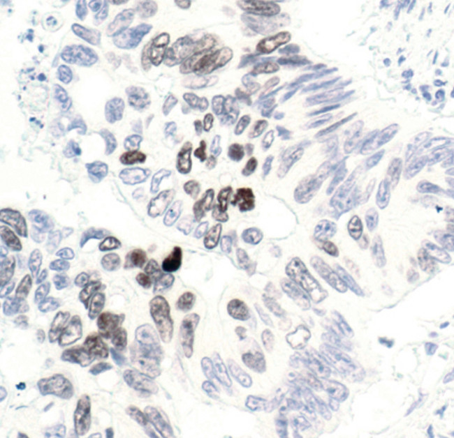 Phospho-Histone H3 (Thr3) Antibody in Immunohistochemistry (Paraffin) (IHC (P))
