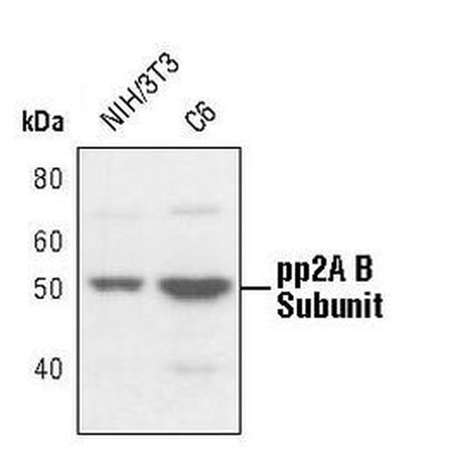 PPP2R2A Antibody in Western Blot (WB)