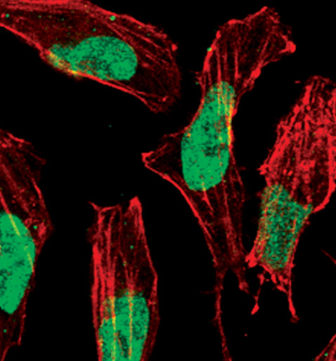 Phospho-p57 Kip2 (Thr310) Antibody in Immunocytochemistry (ICC/IF)
