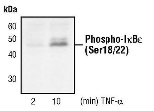 Phospho-IkB epsilon (Ser18, Ser22) Antibody in Western Blot (WB)