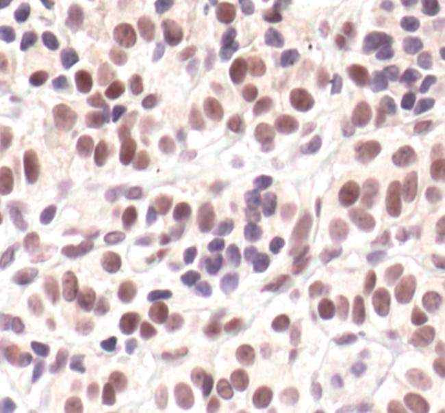 Phospho-Cyclin E (Thr62) Antibody in Immunohistochemistry (Paraffin) (IHC (P))