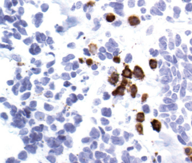 UBC3B Antibody in Immunohistochemistry (IHC)