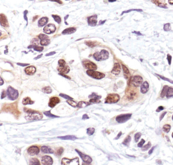 Phospho-p53 (Ser33) Antibody in Immunohistochemistry (Paraffin) (IHC (P))