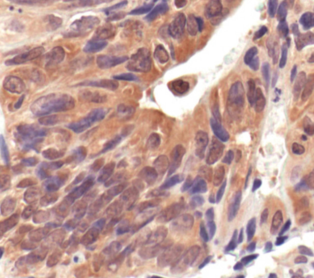 HSP90AB1 (HSP90) Antibody in Immunohistochemistry (IHC)