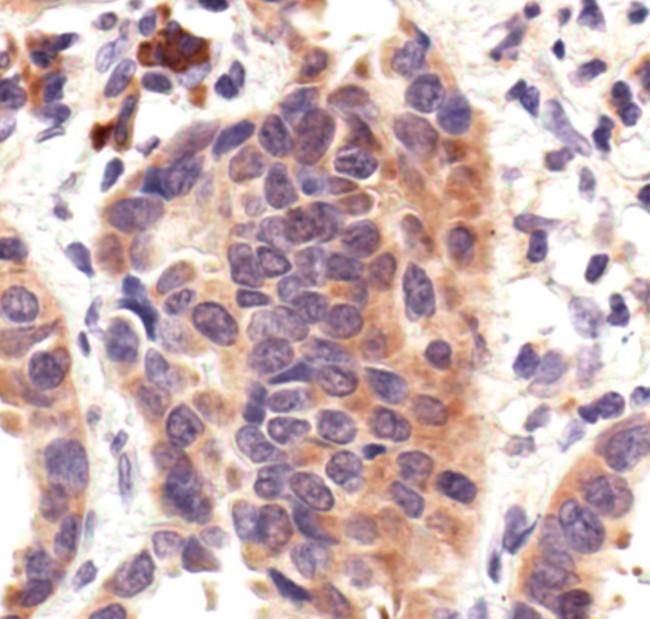HSP70 Antibody in Immunohistochemistry (IHC)